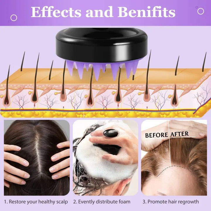 1 Piece Scalp Massager Shampoo Brush – Silicone Hair Scalp Scrubber for Deep Cleaning & Relaxing Massage (Multicolor, Pack of 1)