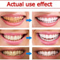 Yayashi SP-4 Ultra Whitening Toothpaste – 150ml Probiotic Stain Remover for Bright, Healthy Teeth