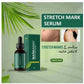 Markaway DermaRepair Stretch Mark Therapy Serum Advanced Care For Skin Smoothness Restoration And Visible Mark Reduction - 30ML